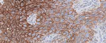 Image of the PD-L1 IHC 22C3 pharmDx Cervical Cancer Interpretation Manual